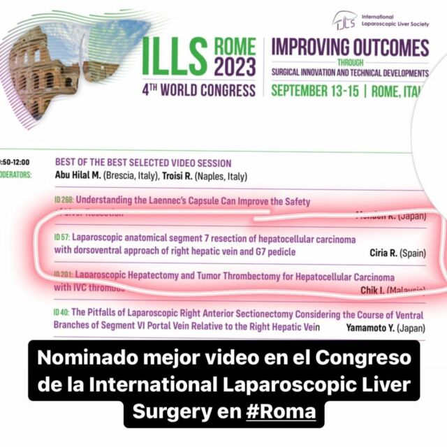 Nominado best of the best video en el Congreso de la International Laparoscopic Liver Surgery. Muy agradecido y honrado. @cordobabn @diario_cordoba @hureinasofia @quironsalud @aecirujanos @contraelcancer.cordoba #cirugia #salud #medicina #surgery #cirujano #laparoscopia #cancer #metastasis